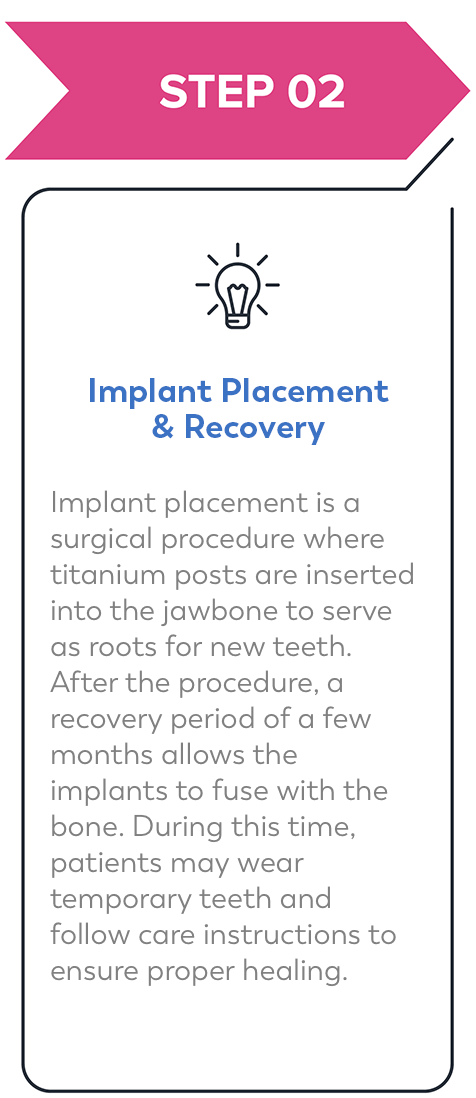 Step 2: How The All-On-4 Procedure Works
